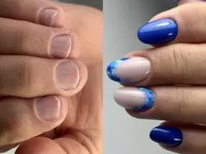 CORSO FOCUS ONICOFAGIA – Iris Nails Academy