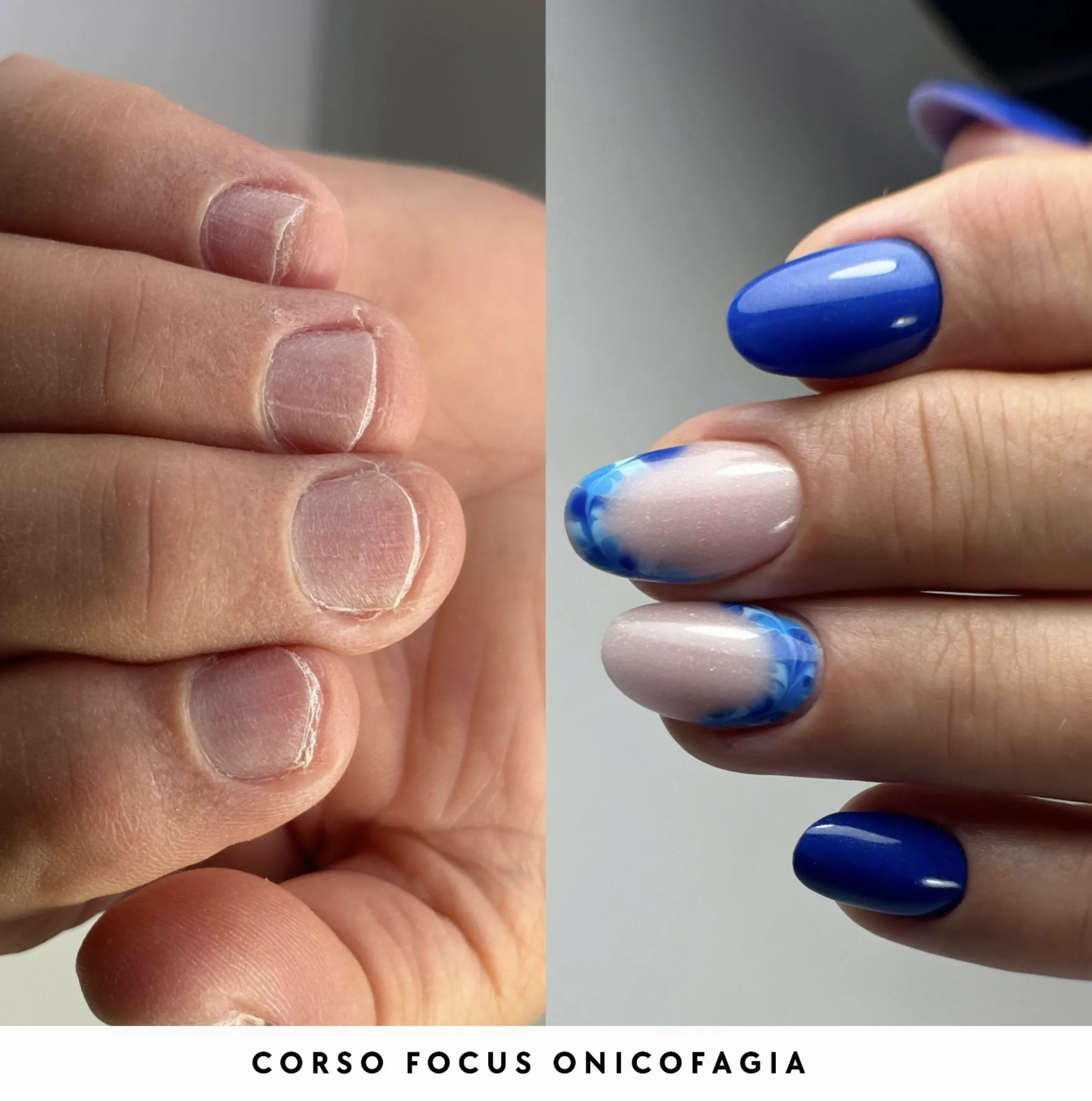 CORSO FOCUS ONICOFAGIA – Iris Nails Academy
